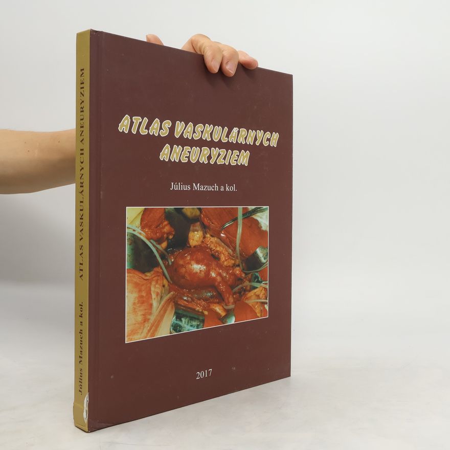 Július Mazuch Atlas vaskulárnych aneuryziem