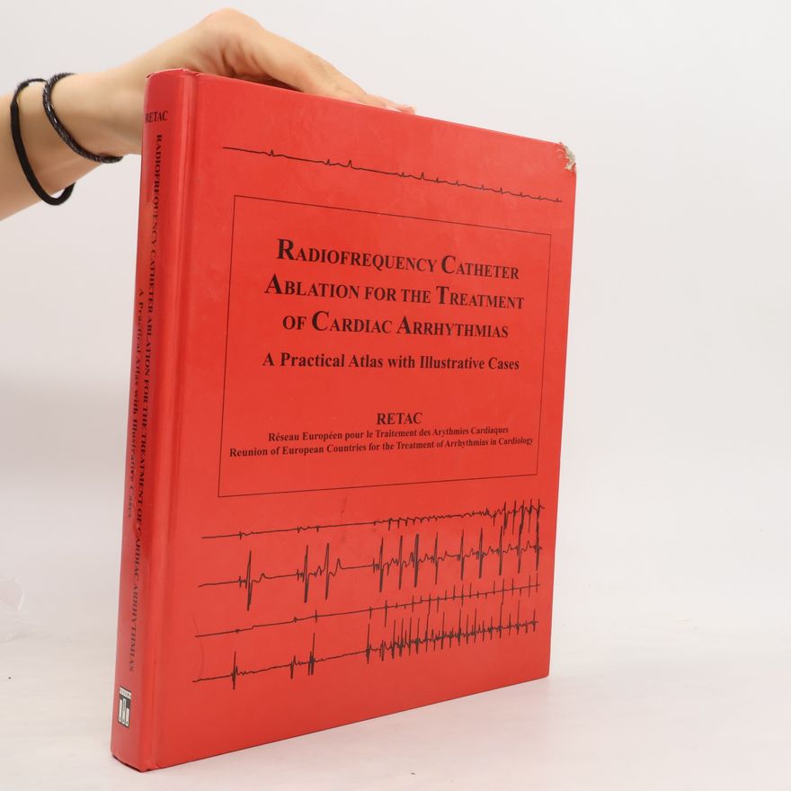 Kolektiv autorů Radiofrequency Catheter Ablation for the Treatment of Cardiac Arrhythmias