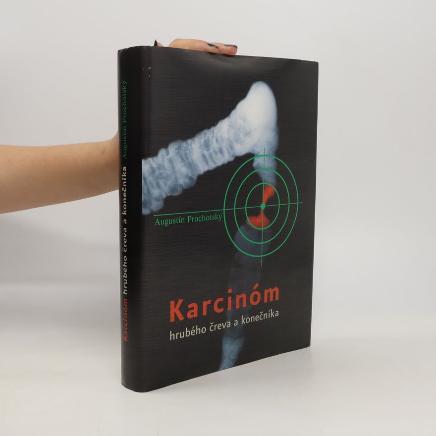 Augustín Prochotský Karcinóm hrubého čreva a konečníka