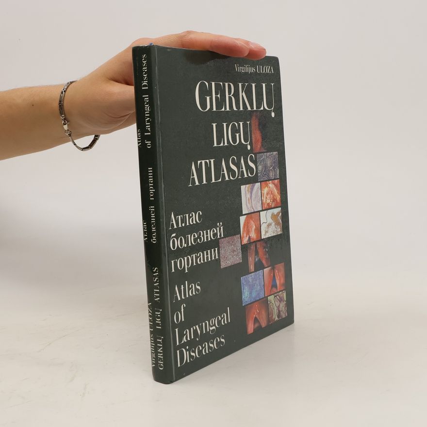 Virgilijus Uloza Atlas of Laryngeal Diseases. Gerklų ligų atlasas. Aтлас болезней гортани.