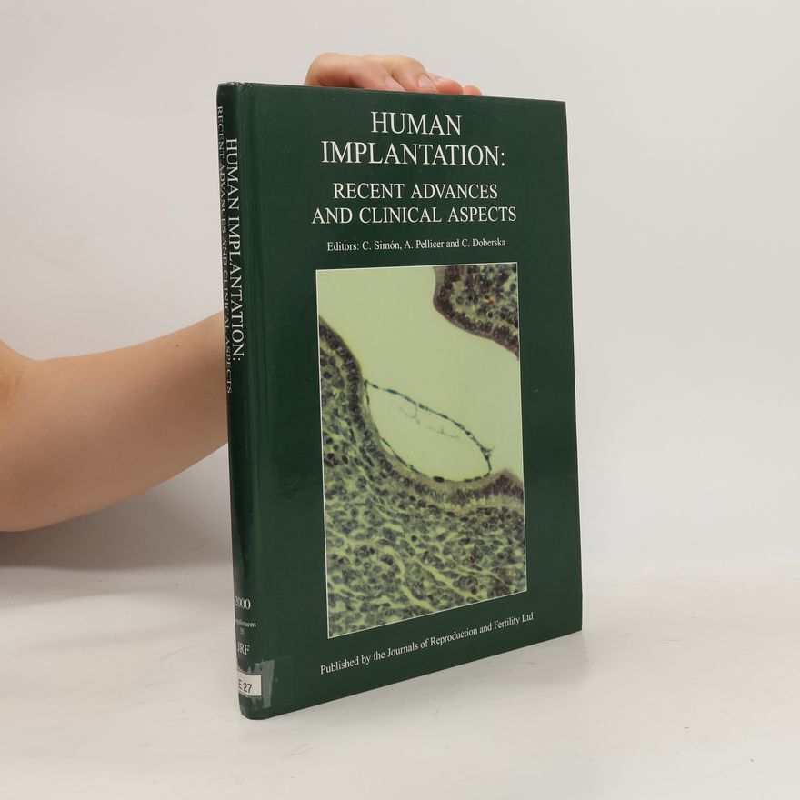 Kolektiv autorů Human Implantation