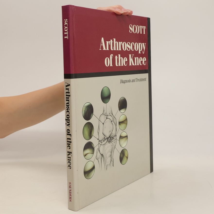 W. Norman Scott Arthroscopy of the Knee