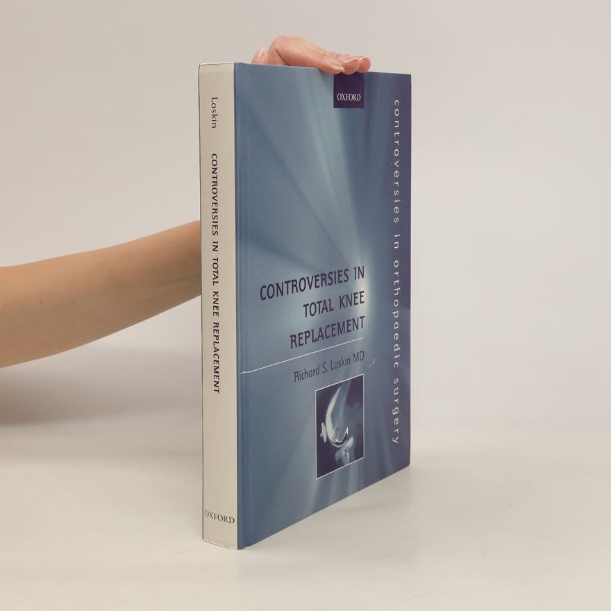 Richard S. Laskin Controversies in Total Knee Replacement