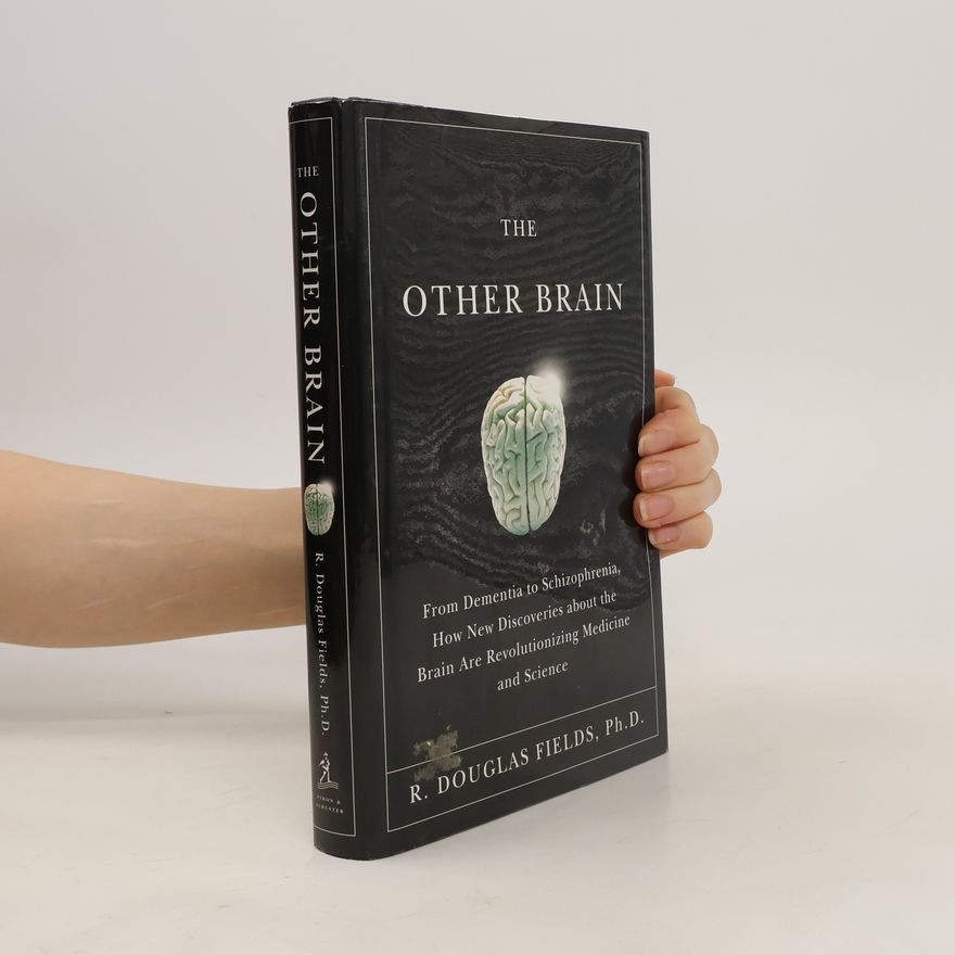 Doug Stinson The Other Brain