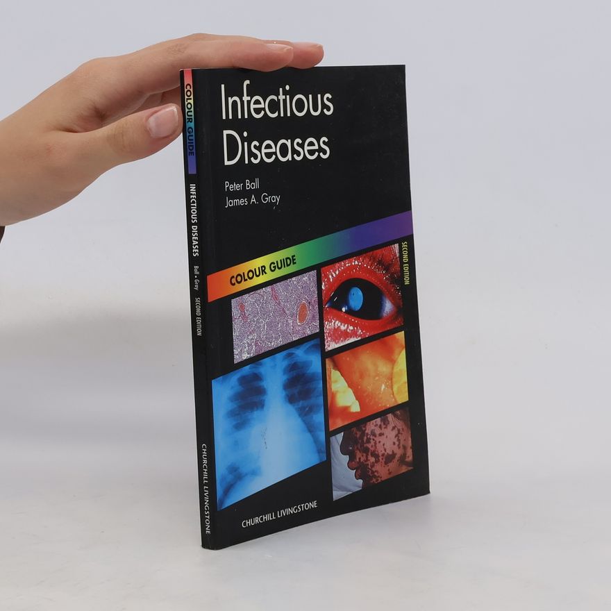 James A Gray Infectious diseases