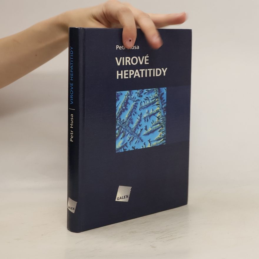 Petr Husa Virové hepatitidy