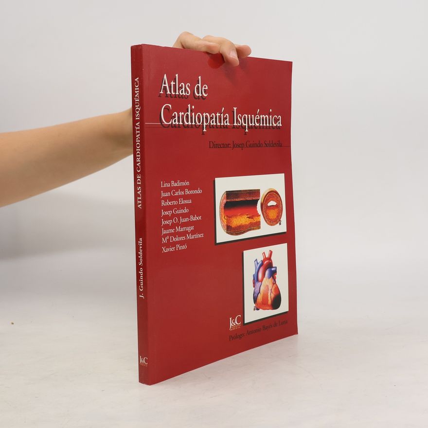 Collectif d'auteurs Atlas de Cardiopatía Isquémica