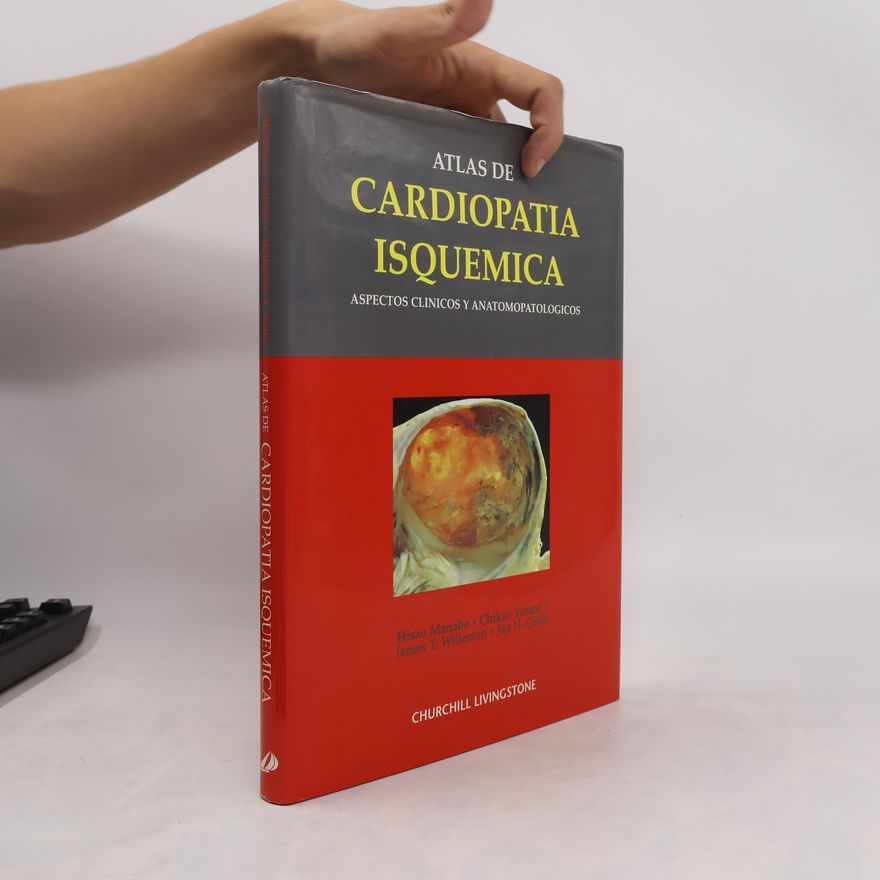 Various authors Atlas de cardiopatia isquemica