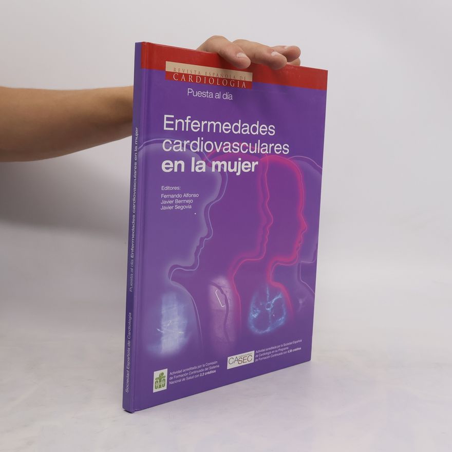 Javier Bermejo Enfermedades cardiovasculares en la mujer
