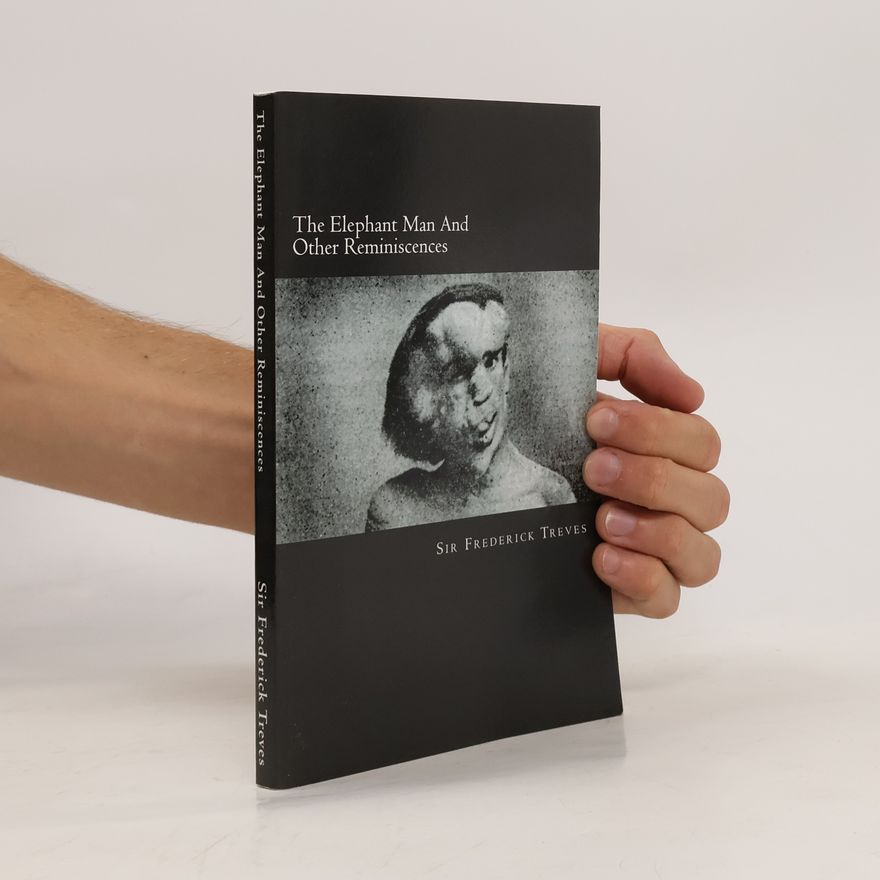 Frederick Treves The Elephant Man and Other Reminiscences