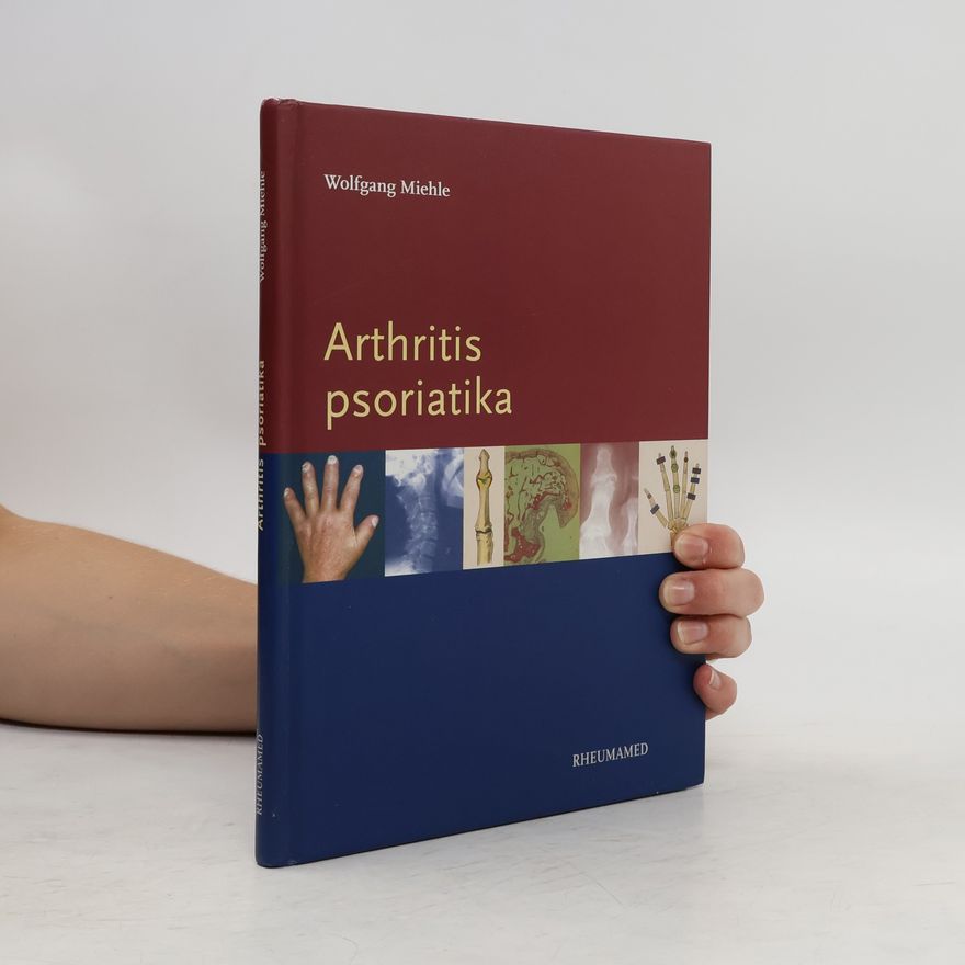 Wolfgang Miehle Arthritis psoriatika