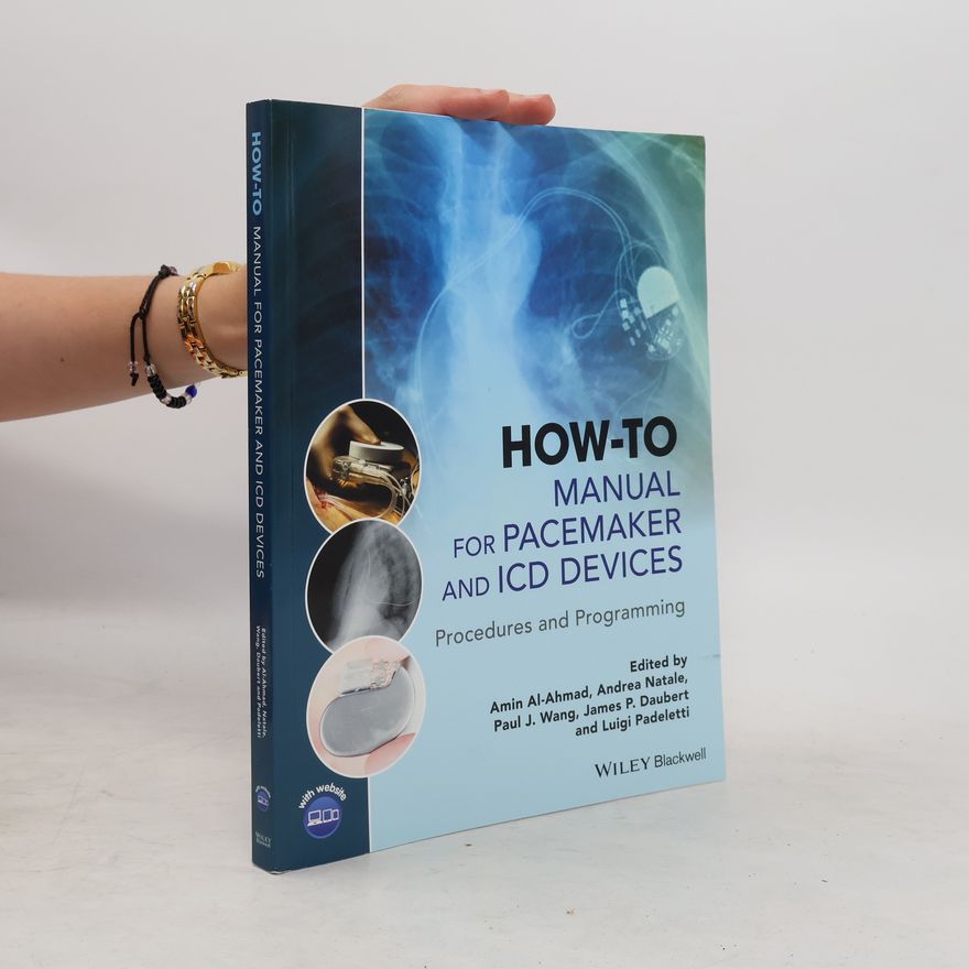Kolektiv autorů How-to Manual for Pacemaker and ICD Devices