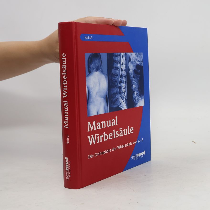 Autorenkollektiv Manual Wirbelsäule