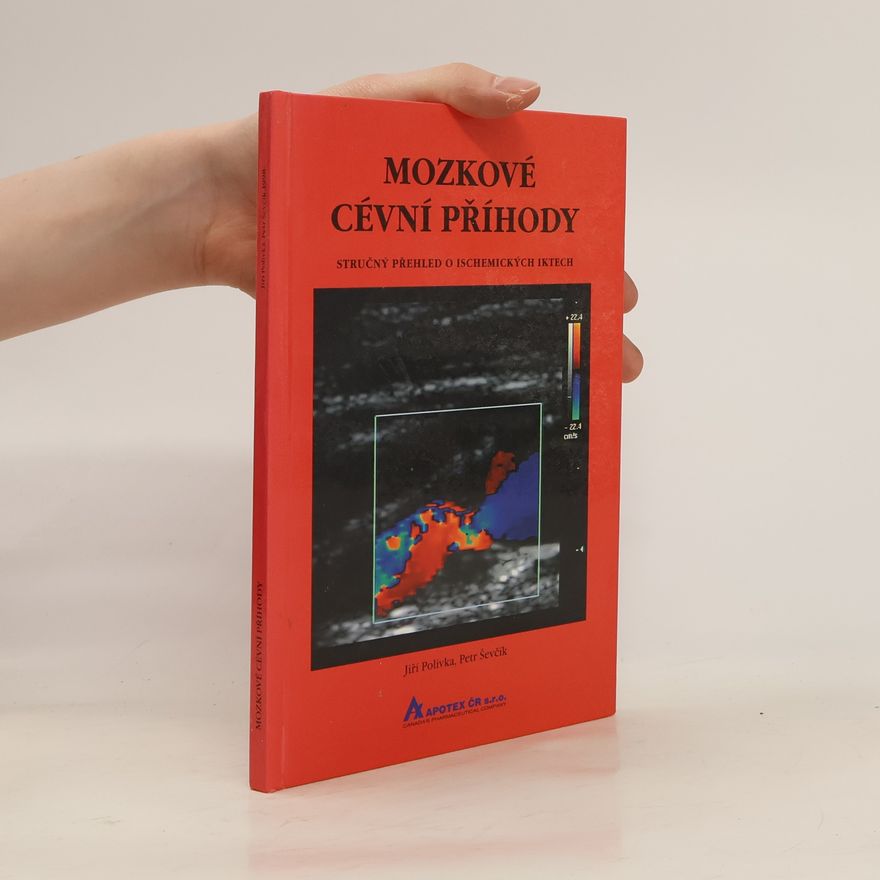 Petr Ševčík Mozkové cévní příhody