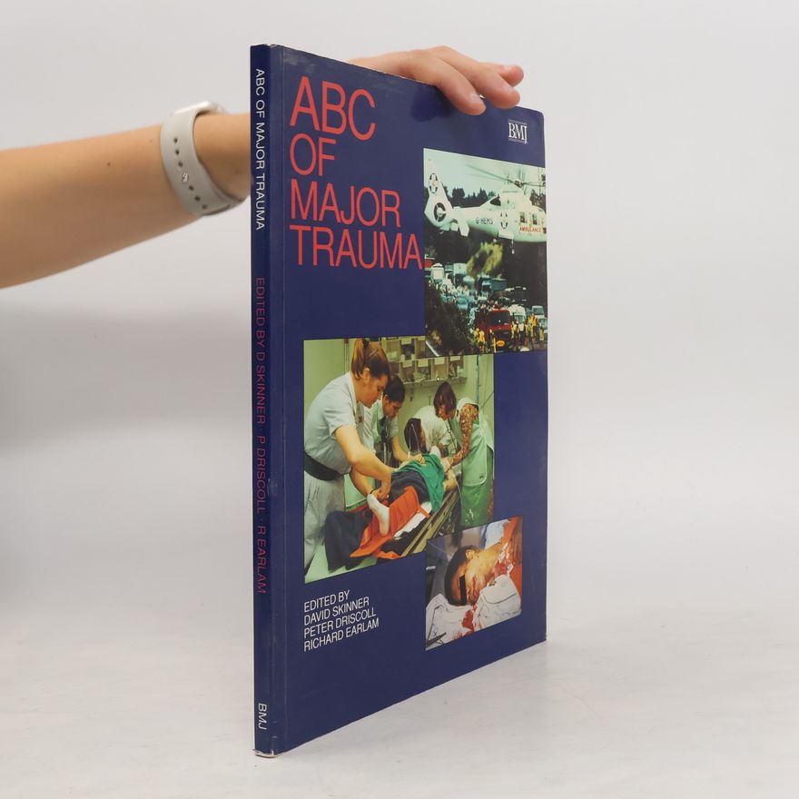 Kolektiv autorů ABC of Major Trauma