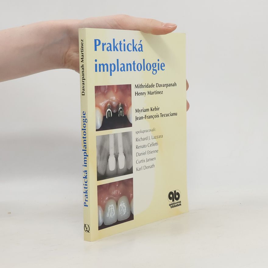 Richard Lazzara Praktická implantologie