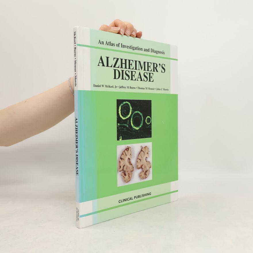 Thomas M Meuser Alzheimer's Disease