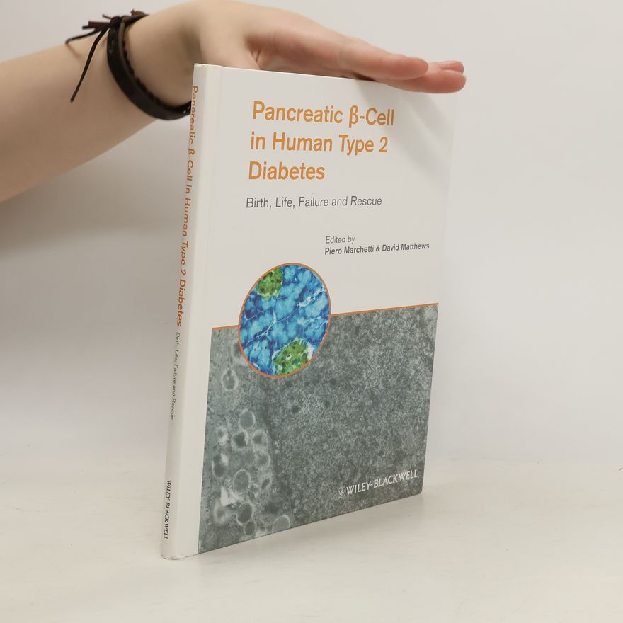 Piero Marchetti Pancreatic Beta Cell in Human Type 2 Diabetes