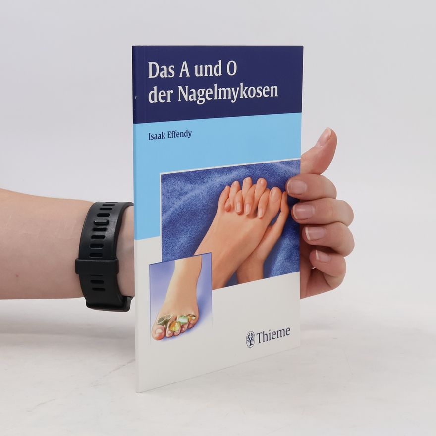 Isaak Effendy Das A und O der Nagelmykosen