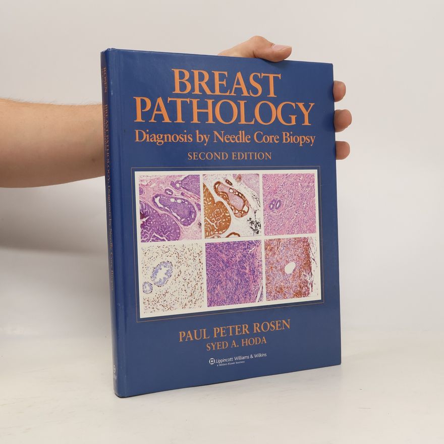 Syed A. Hoda Breast Pathology