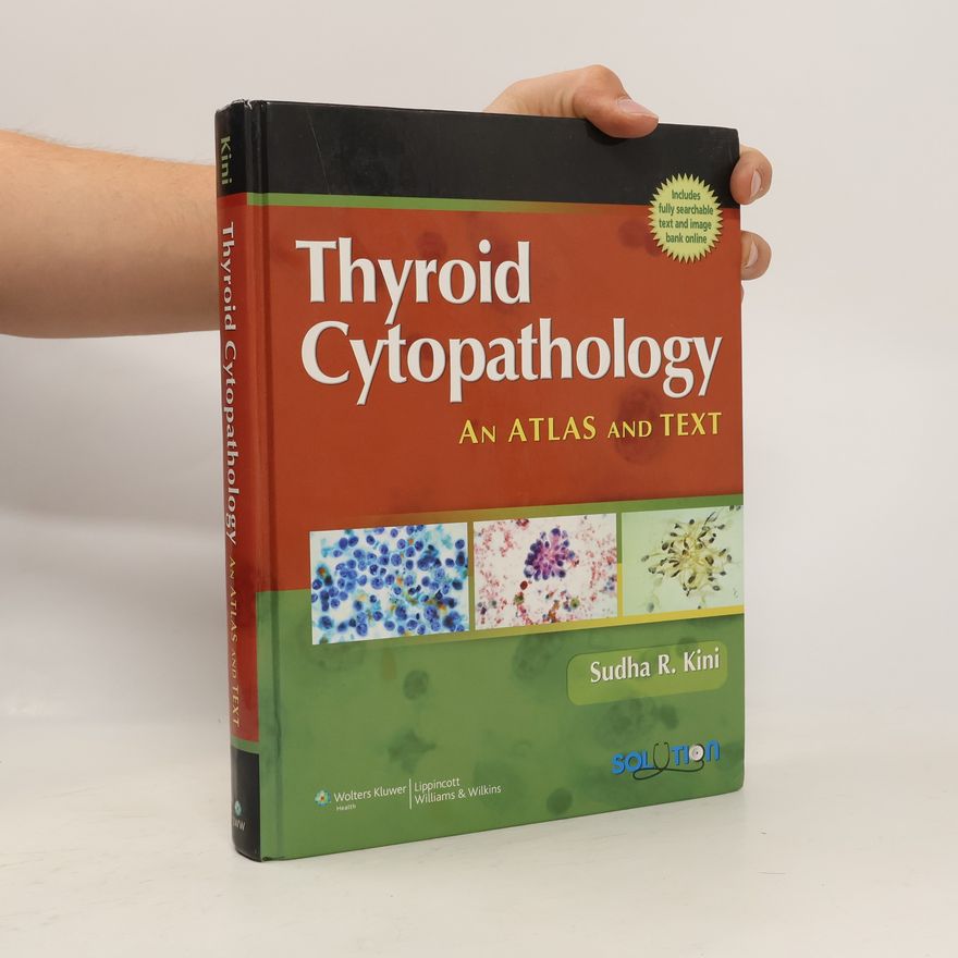 Sudha R. Kini Thyroid Cytopathology