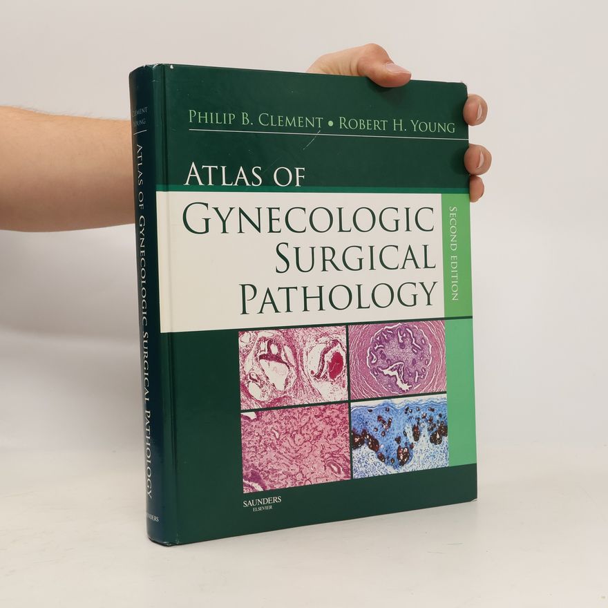 Philip B. Clement Atlas of Gynecologic Surgical Pathology