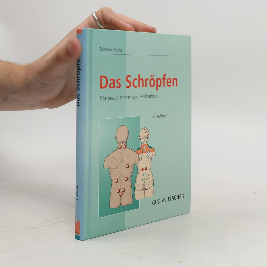 Johann Abele Das Schröpfen