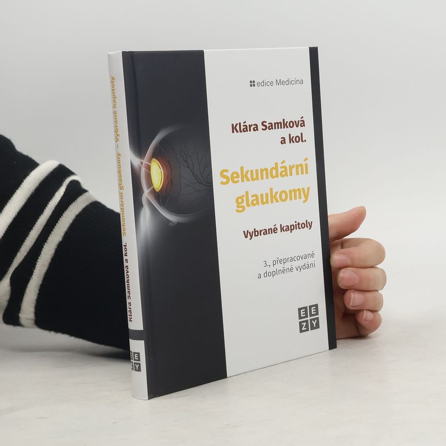 Klára A. Samková Sekundární glaukomy - Vybrané kapitoly