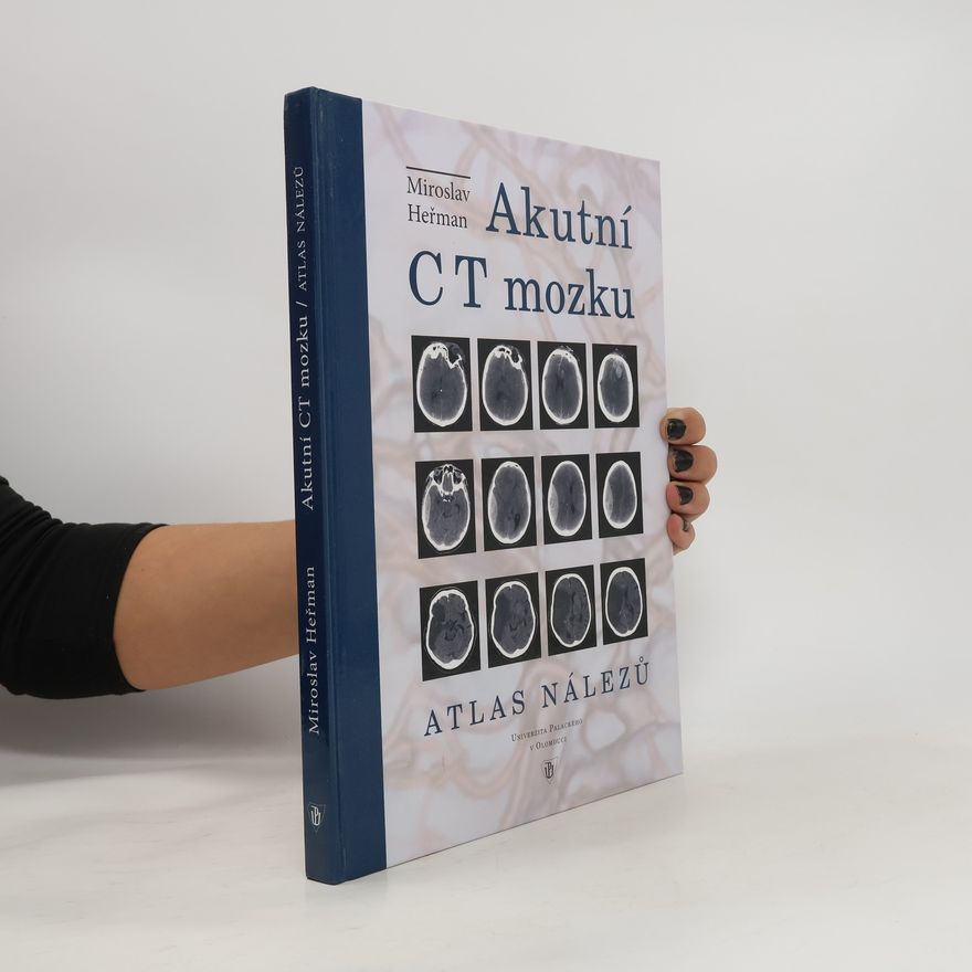 Miroslav Heřman Akutní CT mozku. Atlas nálezů