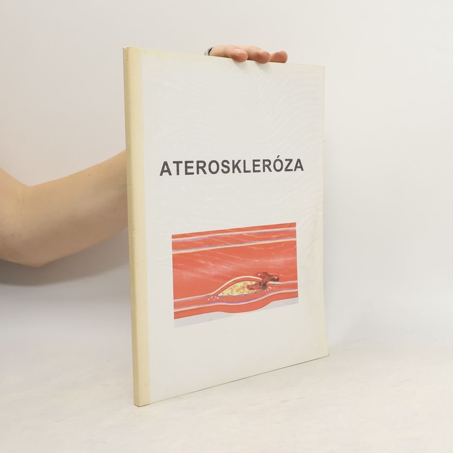 Kolektiv autorů Ateroskleróza