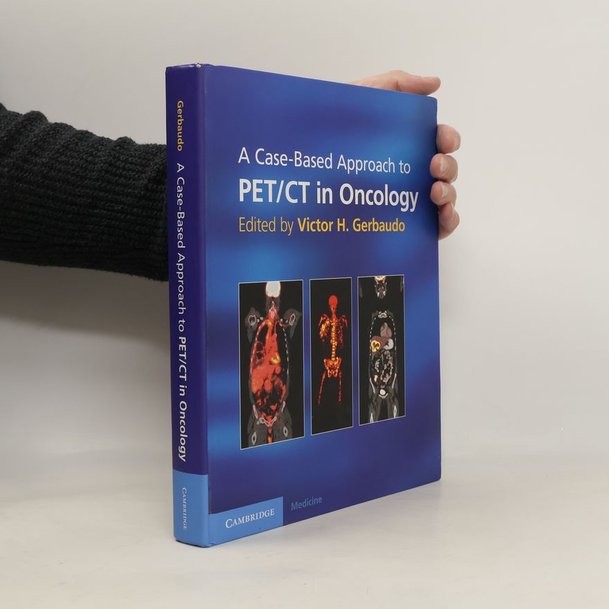 Victor H. Gerbaudo Cambridge Medicine: A Case-Based Approach to PET/CT in Oncology