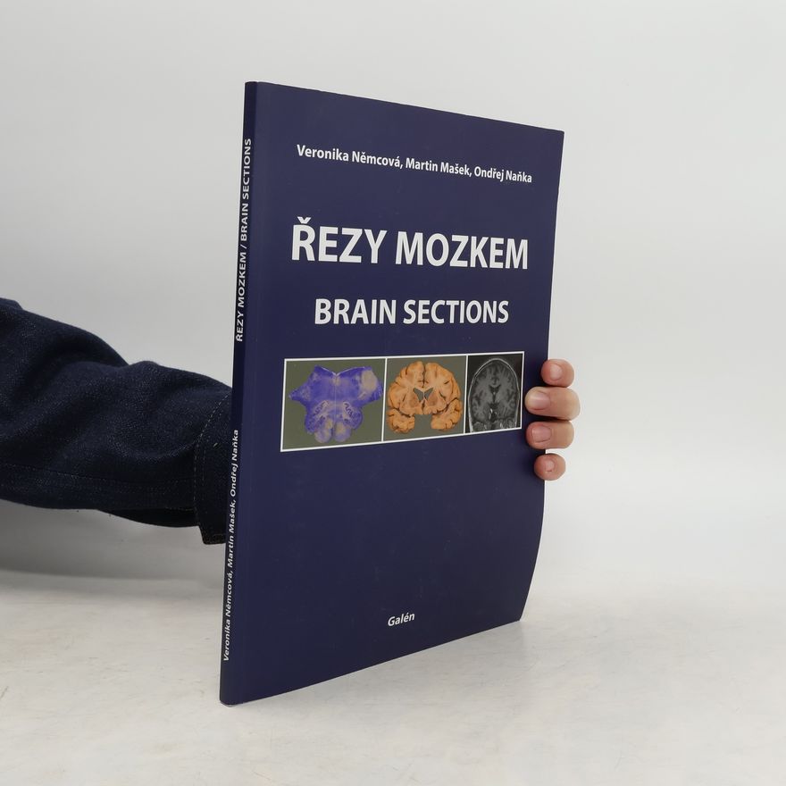 Veronika Němcová Řezy mozkem : atlas makroskopických, mikroskopických a MRI řezů = Brain sections : atlas of macroscopic, microscopic and MRI sections