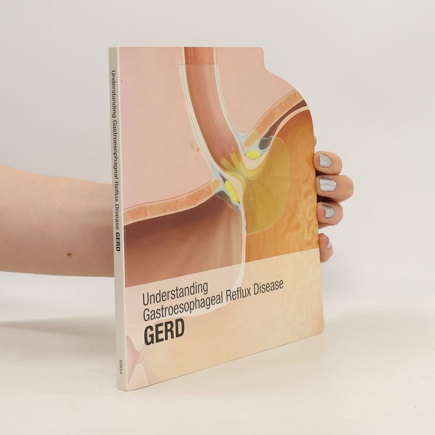 Collectif d'auteurs Understanding Gastroesophageal Reflux Disease Gerd