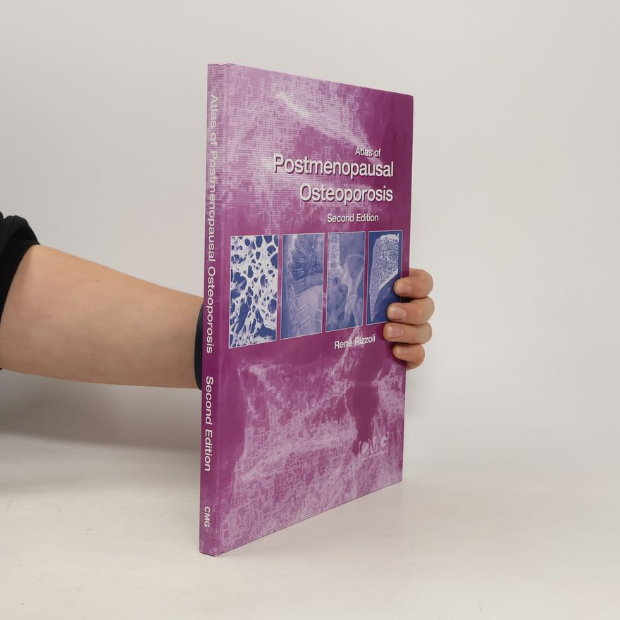 René Rizzoli Atlas of Postmenopausal Osteoporosis