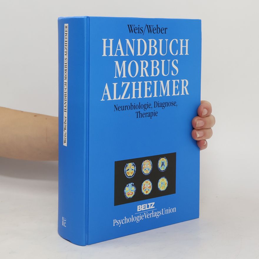Serge Weis Handbuch Morbus Alzheimer