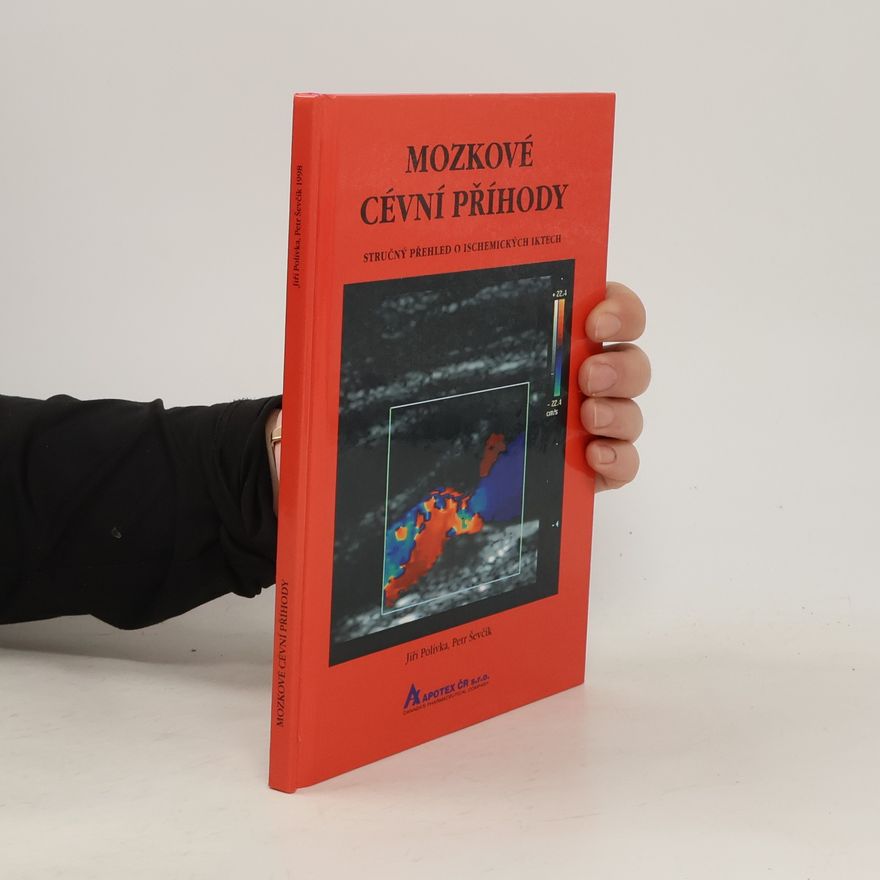 Petr Ševčík Mozkové cévní příhody