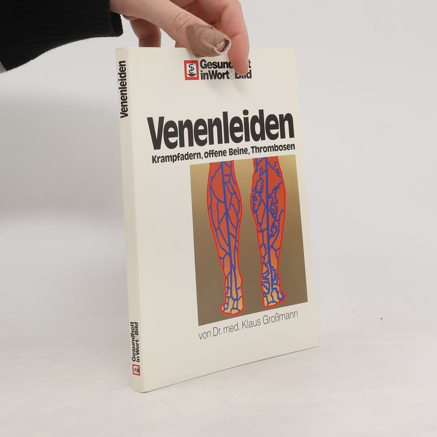 Klaus Großmann Venenleiden