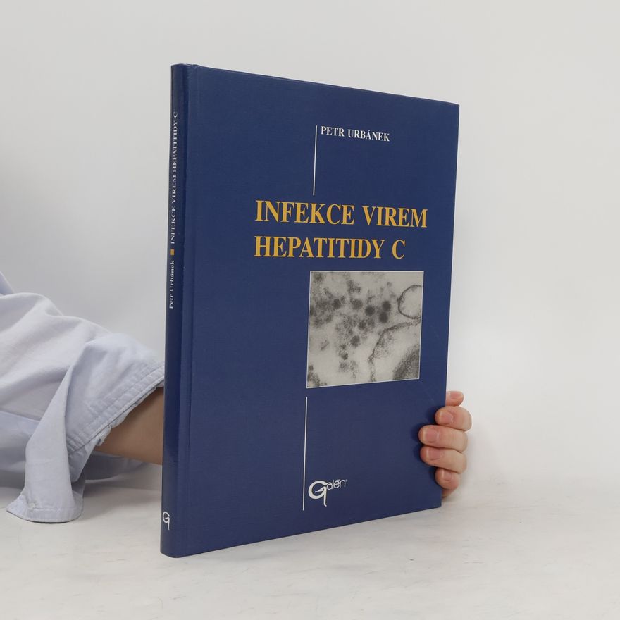 Petr Urbánek Infekce virem hepatitidy C
