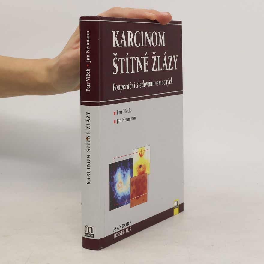 Jan Neumann Karcinom štítné žlázy : pooperační sledování nemocných