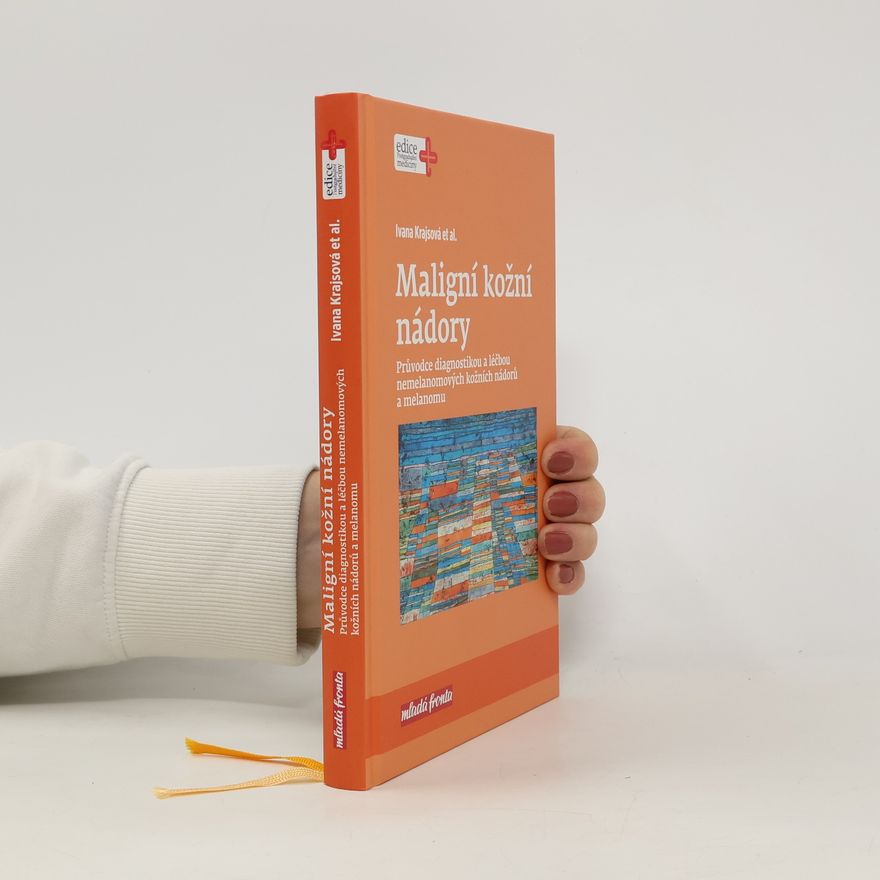 Ivana Krajsová Maligní kožní nádory