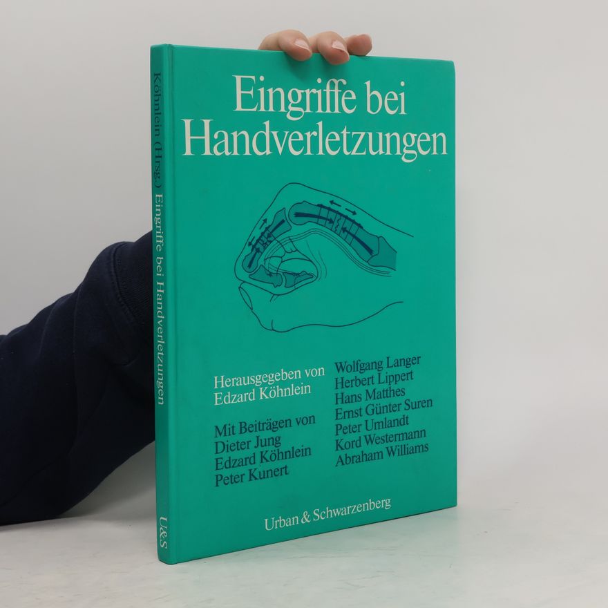 Heinz-Edzard Köhnlein Eingriffe bei Handverletzungen