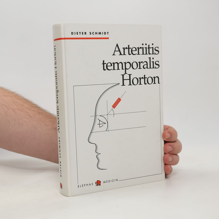 Wolf-Dieter Schmidt Arteriitis temporalis Horton