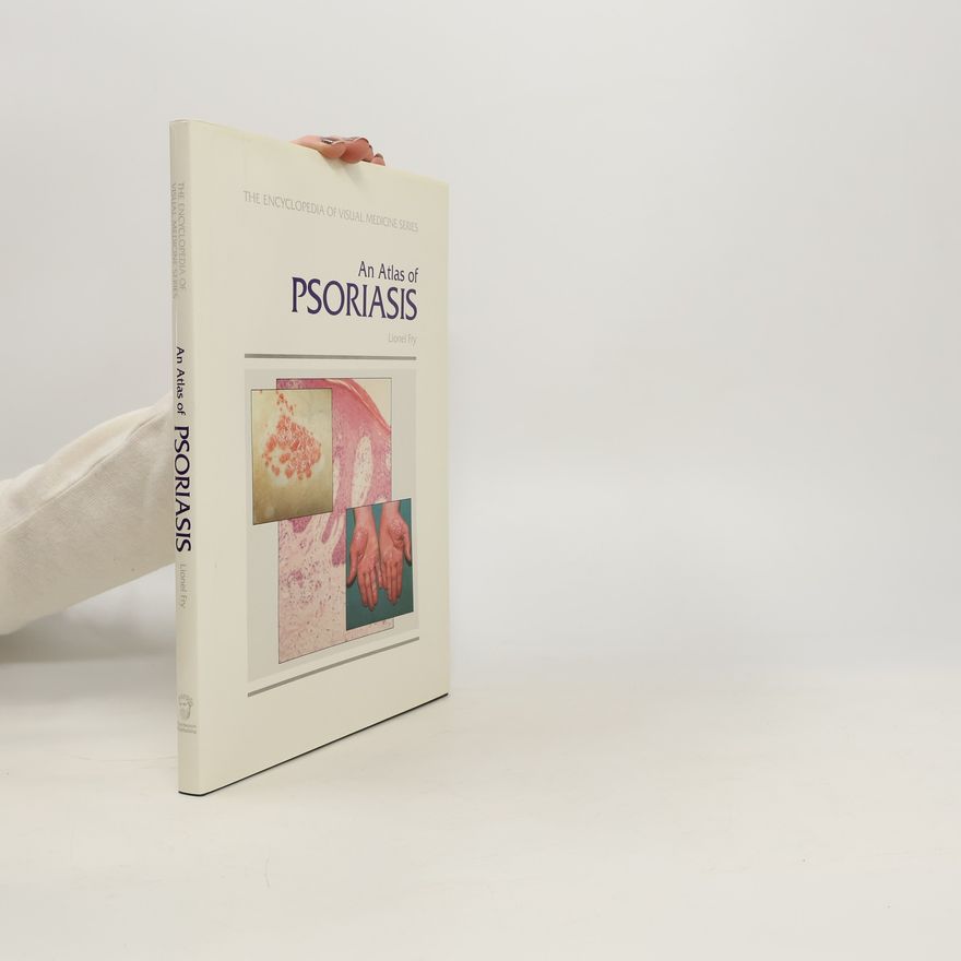 Lionel Fry An Atlas of Psoriasis