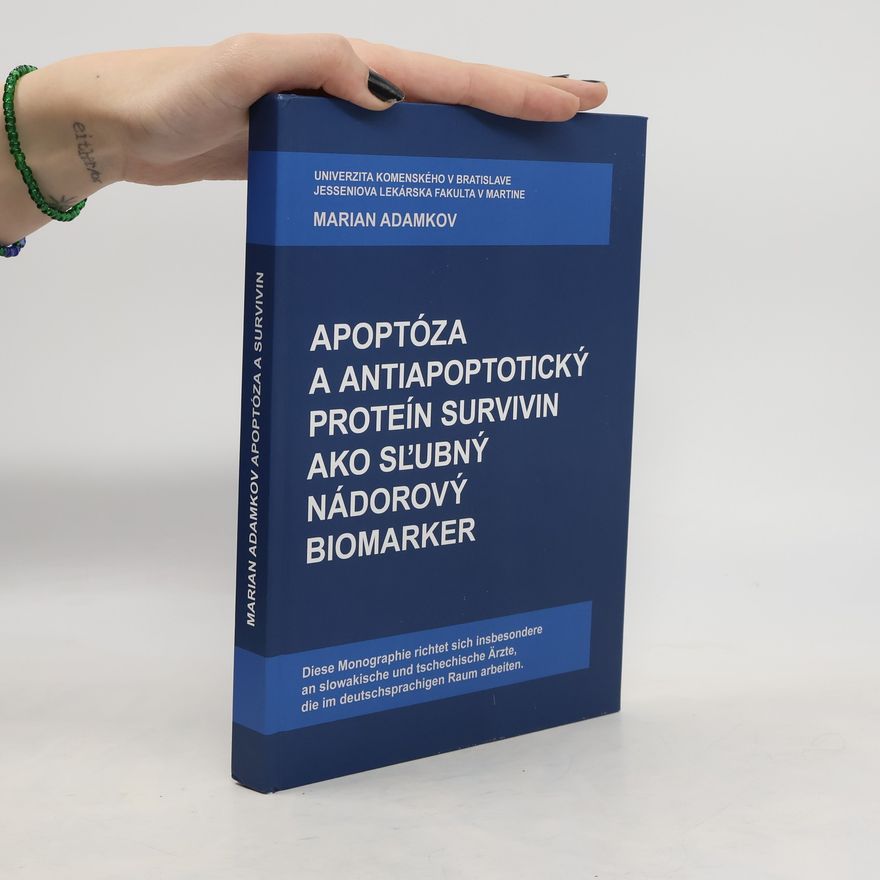 Marian Adamkov Apoptóza a antiapoptotický proteín survivin ako sľubný nádorový biomarker