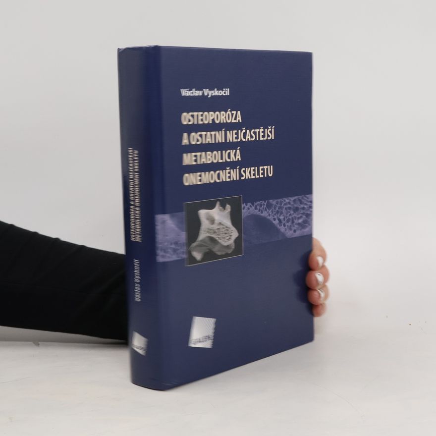 Václav Vyskočil Osteoporóza a ostatní nejčastější metabolická onemocnění skeletu
