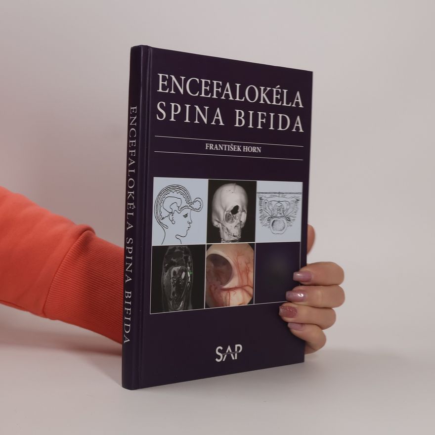 František Horn Encefalokéla spina bifida