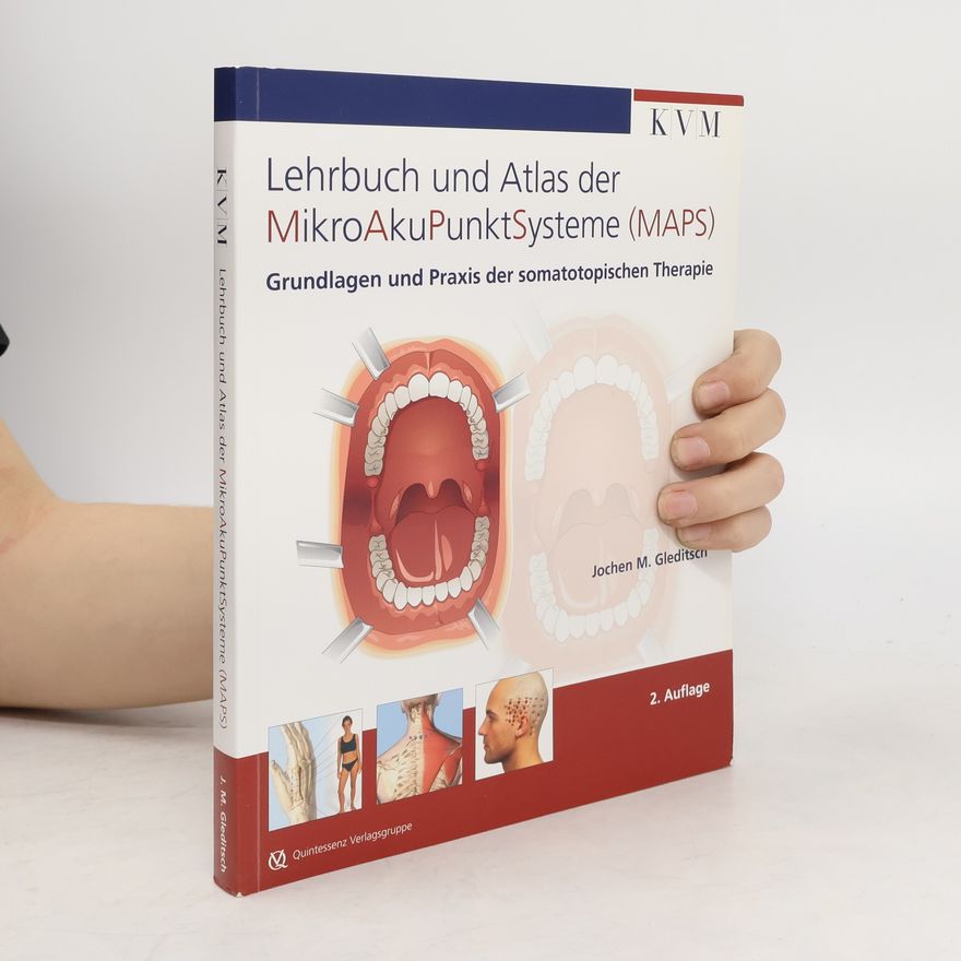 Jochen M. Gleditsch Lehrbuch und Atlas der MikroAkuPunktSysteme (MAPS)