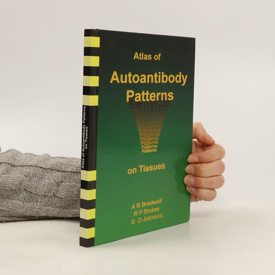 G. D. Johnson Atlas of Autoantibody Patterns on Tissues