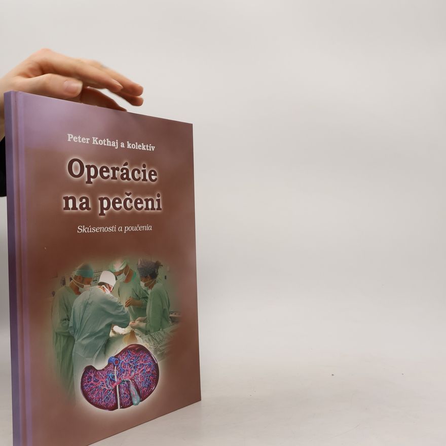 Peter Kothaj Operácie na pečeni : skúsenosti a poučenia