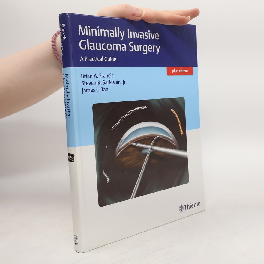 Brian A. Francis Minimally Invasive Glaucoma Surgery